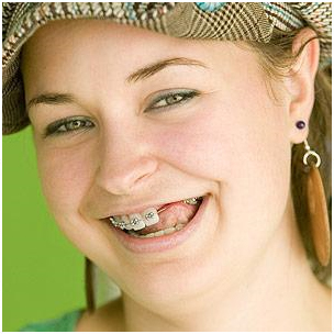 Missing teeth orthodontic treatment